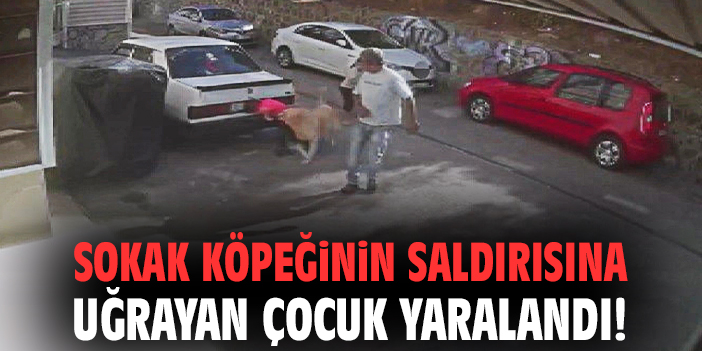 Şok Eden Olay: Küçük Çocuğu Köpek Isırdı!