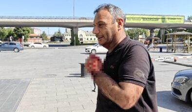 Kurban Bayramı’nda Kesim Kazaları Artıyor!