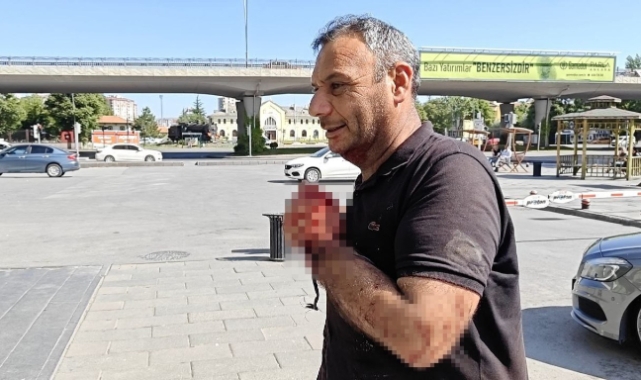 Kurban Bayramı’nda Kesim Kazaları Artıyor!