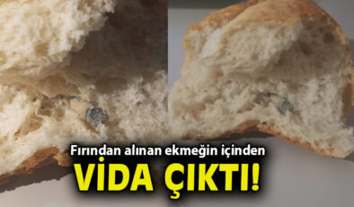 Ekmeğin İçinden Vida Çıktı, Aile Şokta!