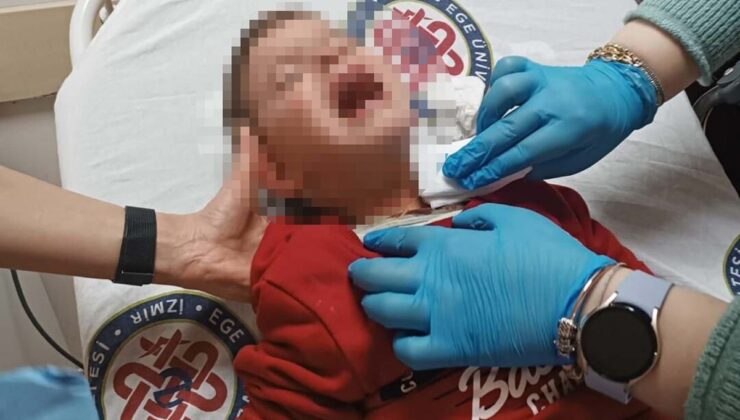 Parkta Bıçaklı Saldırı: 2 Yaşındaki Çocuk Yaralandı